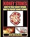 Kidney Stones: How To Treat Kidney Stones: How To Prevent Kidney Stones (Kidney Stone Treatment & Prevention Guide with All)