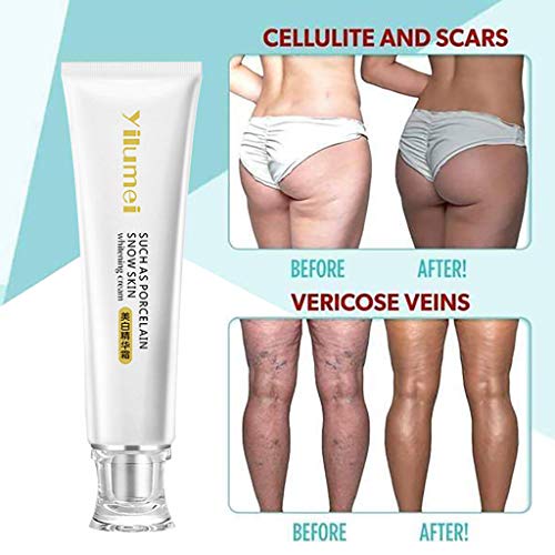 yilumei beauty essence cream