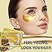 Foase Collagen Under Eye Patches – 24K Gold Hyaluronic Treatment Mask for Dark Circles, Eye Bags & Puffiness – 100% Natural Pads – 20 Pairs (Packaging may vary)thumb 2