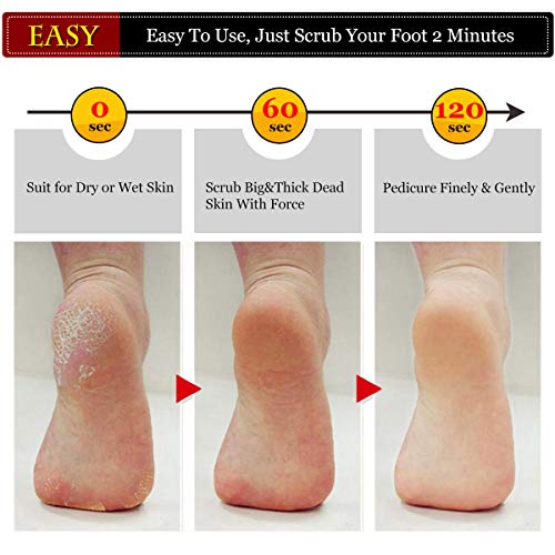 image for Antonki Colossal Foot Scrubber Foot File Useful Professional Pedicure 