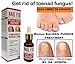 Antifungal FEM Get rid of toenail Fungus Uñas libres de Hongos 15 mlthumb 2