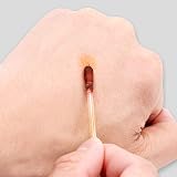 EXCEART 100Pcs Disposable Iodine Cotton Swabs Medical First Aid Pack view 2