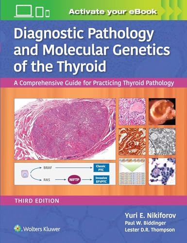 Heptinstall's Pathology of the Kidney: 9781975161538: Medicine