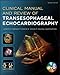 Clinical Manual and Review of Transesophageal Echocardiography