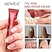 2pcs Fungus Nail Renewal Treatment, Aliver The Herb Foot Nail Repair Cream Protector, Nail Care Treatment of Anti-Fungal Cream, Effective Against Nail Fungus, Restores the Healthy Appearance of Nails