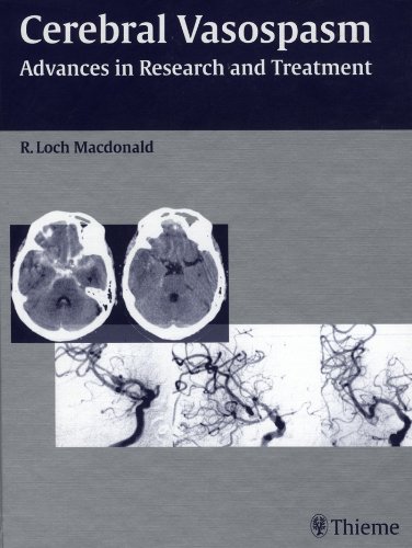 Cerebral Vasospasm: Advances in Research and Treatment by R. Loch Macdonald