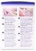 Unistik 3 Gentle Safety Lancets - Box of 100-30G with 1.5mm Penetration Depth
