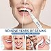 Bestidy Teeth Whitening Pen (2 Pack), Natural Teeth Whitening Gel,Teeth Whitening Kit,Natural Carbamide Peroxide Gel,Removes Years of Stains,Organic Charcoal On The Go
