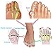 Toe Separator,Toe Spacers for Men Women Toe Bunion Pain Correct Relief Toe Straightener for Hammer Toe by Explore Lifez. (1 pair)