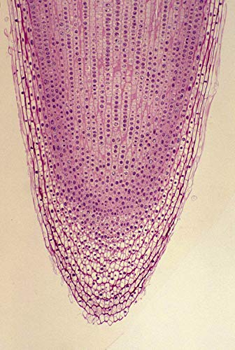 Prepared Apologia Biology Microscope Slides Set, Pack of 16pcs Specimens Specifically for Biology Course