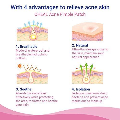 OHeal Acne Pimple Master Patch 108 dots - Absorbing Hydrocolloid Blemish Spot Skin Treatment (108 Patches, 3Pack)