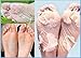 Japanese Hyaluronic Acid Baby Feet Highly Effective Peeling Foot Mask Stop Unpleasant Odor Remove Calluses and Dead Skin Treat Cracked Heels - 2 socks
