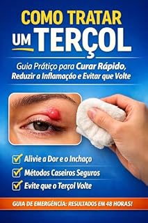 Livro Como Tratar um Terçol - Guia Prático para Curar Rápido, Reduzir a Inflamação e Evitar que Volte : Tratamentos caseiros, cuidados essenciais e prevenção para eliminar o terçol com segurança