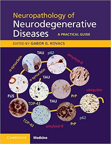 Neuropathology Of Neurodegenerative Diseases Book And Online A Practical Guide 9781107442429 Medicine Health Science Books Amazon Com