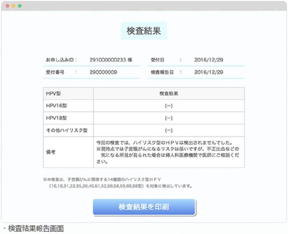 検査 hpv