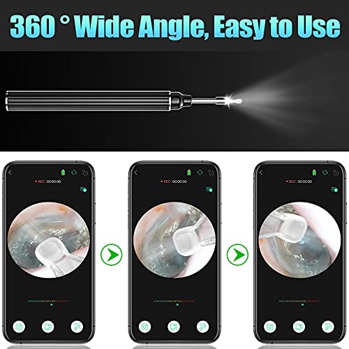 [ 2022 Latest] Ear Wax Removal Endoscope, Aviation Aluminum Earwax