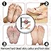 Foot Peel Mask 2 Pack for Smooth Soft Touch Feet - Peeling Away Calluses - Dead Skin Remover - Exfoliating Off Foot Mask for Baby Soft Silk Feet - Gel Socks Booties - Aloe Extract - Natural Rose Scent
