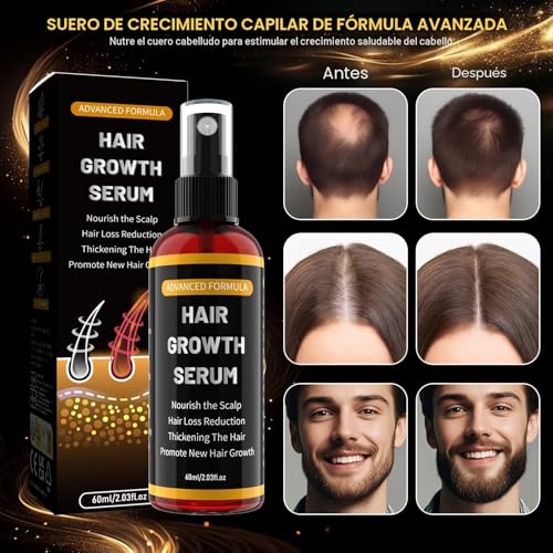 Hair Growth Serum Spray for Men/Women, Accelerate Hair Growth, Prevent Hair Loss, with Biotin & Rosemary for Hair Growth Oil