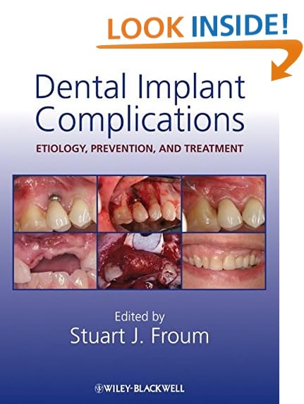 Surgical Manual of Implant Dentistry Stepbystep Procedures