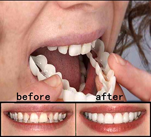 BELONG Cosmetic Dentistry Snap On Smile Instant Perfect Smile Comfort Fit Flex Teeth Fits Most False Teeth Upper Tooth Cover Massager