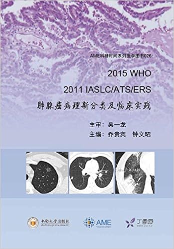 2015 Who 2011 Iaslc Ats Ers Classification Of New Lung Pathology And Clinical Practice 2015 Who 2011 Iaslc Ats Ers 肺腺癌病理新分类及临床实践 乔贵宾 钟文昭 9787548724414 Amazon Com Books