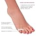 Bunion Relief (12pcs Set) - Treat Foot Pain, Hallux Valgus, Tailor's Bunion, Pain in Big Toe Joint, Hammer Toe and More. Includes Toe Spacers, Separators and Straighteners