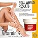 Vitamin K Cream 3.4 oz | High Quality Formula for Bruises, Spider Veins, Dark Circles, Broken Capillaries, Eyes, Face, Legs