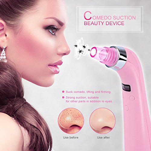 Comedo Suction Tool,CkeyiN Rechargeable Diamond Machine Portable Facial