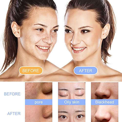 Facial Cleansing Brush, Waterproof Face Brush with 5 Brush Heads,Rotating Deep Cleansing, Gentle Exfoliating, Removing Blackhead for Face and Body