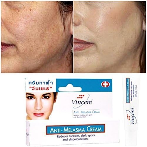 3ÃƒÂ—VINCERE CREAM FOR ANTI MELASMA,FRECKLES,AGE SPOTS,SUN SPOTS,PIGMENTATION by SiamShoppingMall
