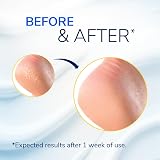 Dr. Scholl's Cracked Heel Repair Balm 2.5oz 25% Urea Dry Cracked Feet view 3