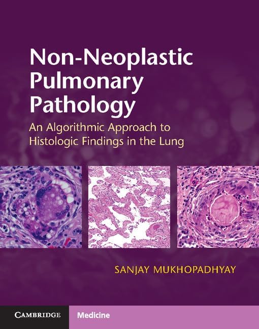 Amazon.com: Microneurosurgery, Vol. 2: Clinical Considerations