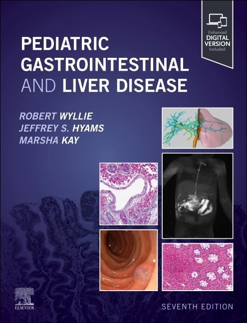 MacSween's Pathology of the Liver: 9780702082283: Medicine