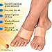 OrthoDoc's Gel Arch Support Brace for Flat Feet Men Women - Plantar Fasciitis Sleeve Pair - Planters Fasciitis Massager - Foot Compression Wrap - Aids High Arch, Fallen Arch, Foot Heel Pain (Fits All)