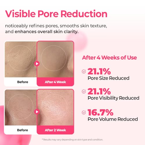 Dr.Melaxin Cyano Pink Spicule Serum with Vitamin B12, Liquid Microneedle Facial Treatment for Enlarged Pores, Niacinamide for Texture Refining & Renewal, 1.01 fl.oz