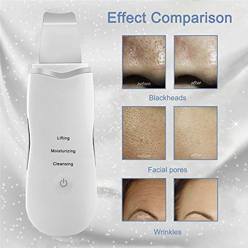Skin Scrubber Spatula Ultrasonic, Blackhead Remover Exfoliator Pore Cleaner Kit, Skin Care Facial Cleansing Tool, Gift Set for Women