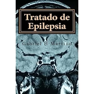 Tratado Epilepsia (Spanish Edition)