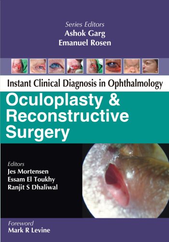 INSTANT CLINICAL DIAGNOSIS IN OPHTHALMOLOGY: OCULOPLASTY AND RECONSTRUCTIVE SURGERY