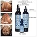 Beaucoup Hair Herbal Hair System For Men Lite - All Natural Hair Growth System - No Side Effects!! Ideal for Combating Hair Loss from Male Pattern Baldness!!