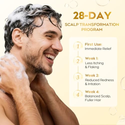 oely Enhanced Antifungal Shampoo for Seborrheic Dermatitis, Folliculitis & Scalp Psoriasis – Anti-Dandruff Shampoo for Men & Women, Relieves Itchy Dry Scalp, Sulfate & Paraben-Free, 10.1 Fl Oz-Fresh