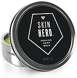 Best Eczema and Psoriasis Treatment + Also Helps with Rosacea - Dermatitis & Rashes. This Natural Cream Instantly Soothes & Hydrates Itchy, Dry Irritated Skin All Over the Body Hands and Feet. 4 Oz