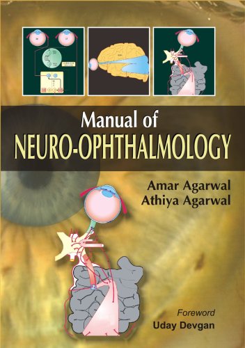 MANUAL OF NEURO-OPHTHALMOLOGY