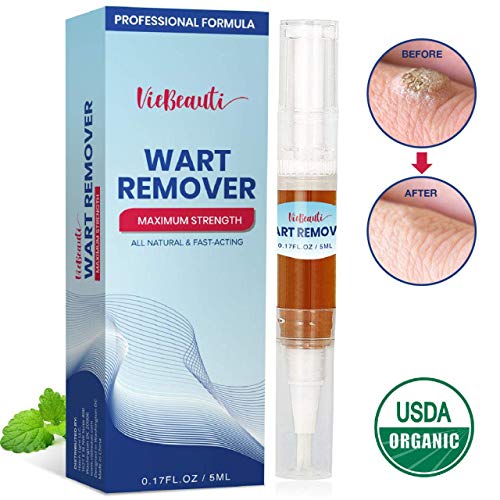 Wart Remover, Plantar Wart Remover, Foot Wart Remover, Corn Callus Remover, Wart Remover Liquid, Common and Plantar Warts Treatment by Amada Pure