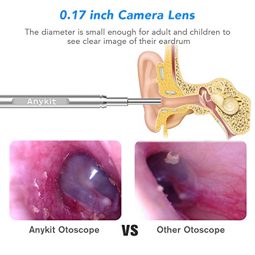 1 Otoscope+Ear+Anykit+Upgraded+Endoscope+Adjustable