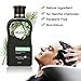 Anti-Hair Loss Shampoo For Men & Women, LuckyFine – Contains Herbal Ingredients, Helps Stop Hair Loss, Hair Growth, Stimulates Hair Re-growth Dandruff Treatment 200ML