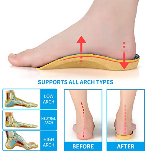 Shoe Insert For Overpronation at Julie Figueroa blog