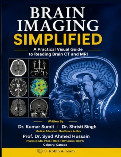 ExpertDDx: Brain and Spine: 9780443106941: Medicine & Health