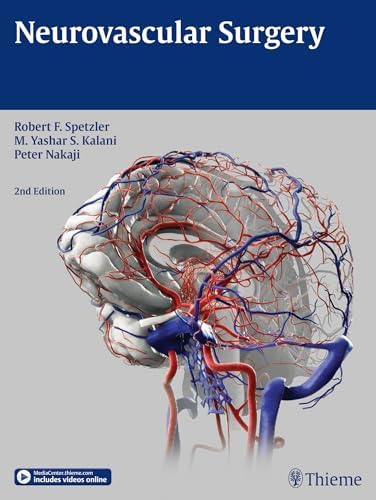Decision Making in Neurovascular Disease: 9781684200573: Medicine