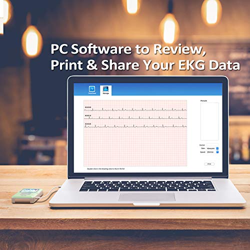 EMAY Heart Health Tracker (PC Software for Windows & Mac) | Heart Rate & Rhythm Recording