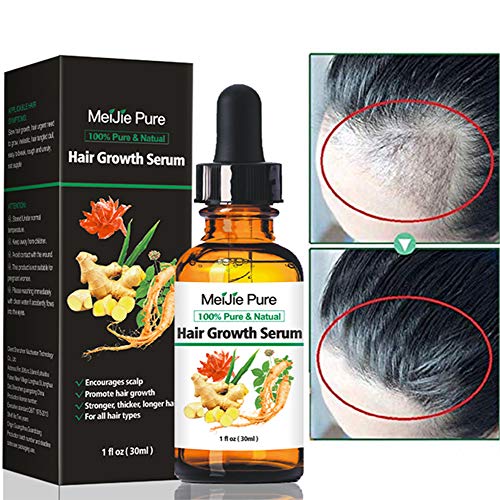 Hair Growth Serum,2019 Hair Growth Treatment,Hair Serum,Anti Hair Loss, Thinning, Balding, Repairs Hair Follicles, Promotes Thicker, Stronger Hair , And Promotes Hair Regrowth